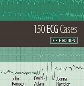 daa9d8aad8a7d8a8 150 ecg cases d988db8cd8b1d8a7db8cd8b4 d9bed986d8acd985 2019 65898871aa3f9