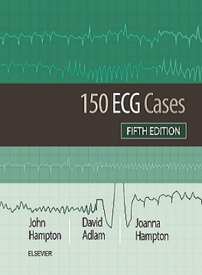 daa9d8aad8a7d8a8 150 ecg cases d988db8cd8b1d8a7db8cd8b4 d9bed986d8acd985 2019 65898871aa3f9